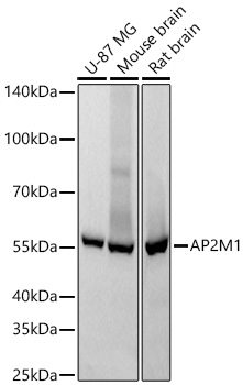 AP2M1 Monoclonal Antibody [10J8D1]