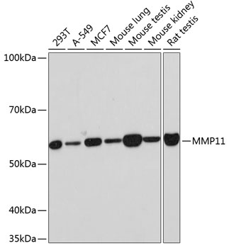 MMP11 Monoclonal Antibody [8N9D3]