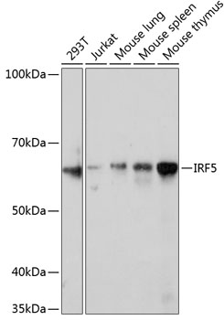 IRF5 Monoclonal Antibody [6L2B5]