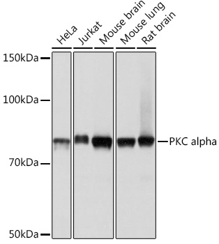 PKC alpha Monoclonal Antibody [1G10S8]