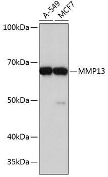 MMP13 Monoclonal Antibody [8L8Q1]