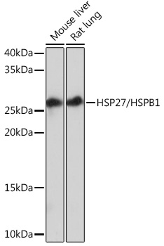 HSP27/HSPB1 Monoclonal Antibody [8V4B8]