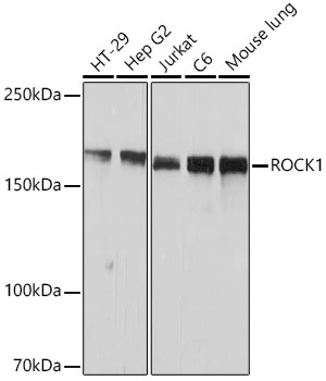 ROCK1 Monoclonal Antibody [H5E4]