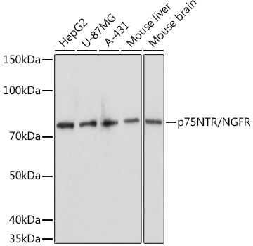 p75NTR/NGFR Polyclonal Antibody