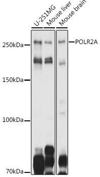 POLR2A Polyclonal Antibody