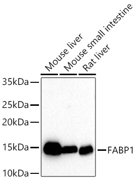 FABP1 Monoclonal Antibody [8Q8S10]