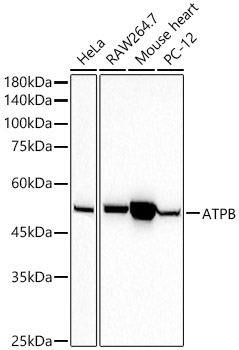 ATPB Monoclonal Antibody [1H2W2]