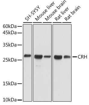 CRH Polyclonal Antibody