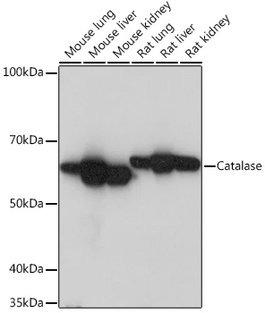 Catalase Monoclonal Antibody [7D2Y4]