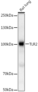 TLR2 Polyclonal Antibody