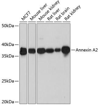 Annexin A2 Monoclonal Antibody [1W2B5]