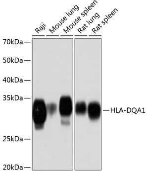 HLA-DQA1 Monoclonal Antibody [7W0M7]