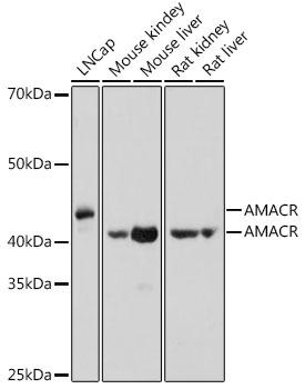 AMACR Polyclonal Antibody