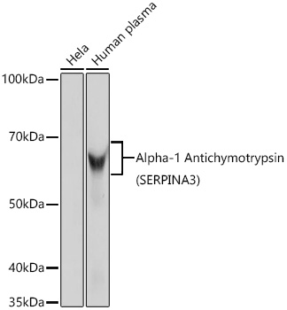 Alpha-1 Antichymotrypsin (SERPINA3) Monoclonal Antibody [4R4B6]