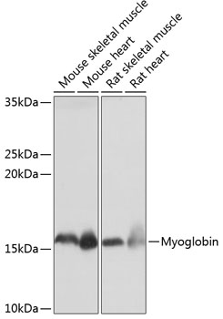Myoglobin Monoclonal Antibody [0R4W0]