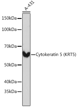 Cytokeratin 5 Monoclonal Antibody [3P3T9]