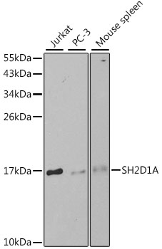 SH2D1A Polyclonal Antibody