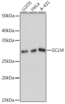 GCLM Monoclonal Antibody [0U3J2]