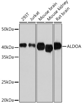 ALDOA Monoclonal Antibody [4B2E5]