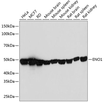ENO1 Monoclonal Antibody [9E5R2]