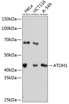 ATOH1 Monoclonal Antibody [7N3G2]