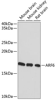 ARF6 Monoclonal Antibody [9E7T9]