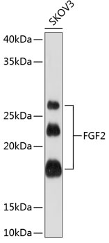 FGF2 Monoclonal Antibody [8W6M5]
