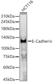E-Cadherin Polyclonal Antibody