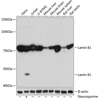 Lamin B1 Monoclonal Antibody