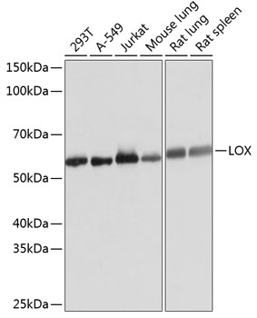 LOX Monoclonal Antibody [9K10Z3]