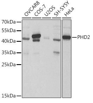 PHD2/EGLN1 Polyclonal Antibody
