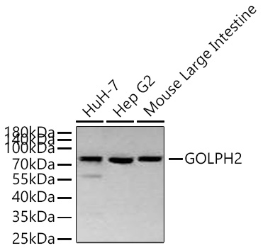 GOLPH2 Monoclonal Antibody [2Q4F0]