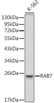 RAB7 Polyclonal Antibody