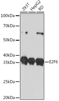E2F6 Monoclonal Antibody [9I5M0]