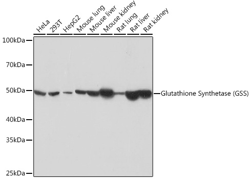 Glutathione Synthetase (GSS) Monoclonal Antibody [2S9W7]