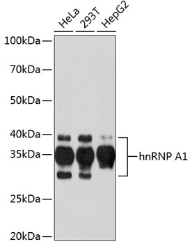 hnRNP A1 Monoclonal Antibody [10N0F4]