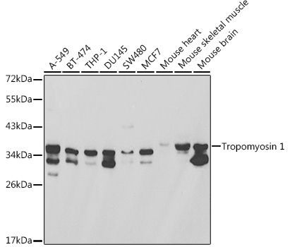 Tropomyosin 1 Polyclonal Antibody