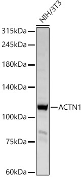 ACTN1 Polyclonal Antibody