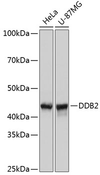 DDB2 Monoclonal Antibody [4Y2G5]