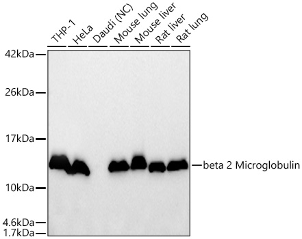 Beta 2 Microglobulin Monoclonal Antibody [5F0O7]