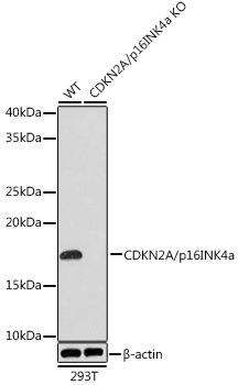 CDKN2A/p16INK4a Monoclonal Antibody [0D0C8]