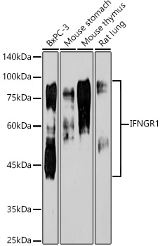 IFNGR1 Monoclonal Antibody [2B9Q1]