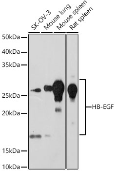 HB-EGF Monoclonal Antibody [9C2M6]