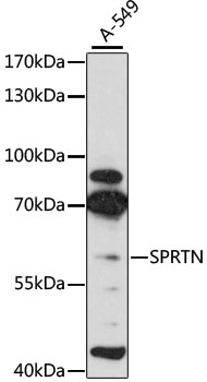 SPRTN Polyclonal Antibody