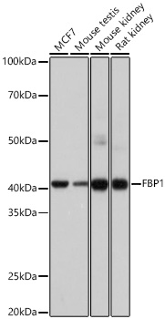 FBP1 Monoclonal Antibody [7N8C1]