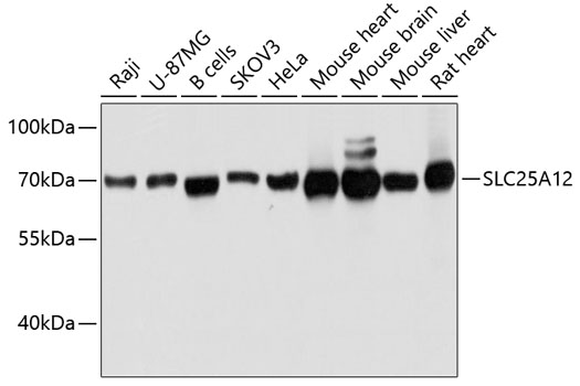 SLC25A12 Polyclonal Antibody