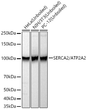 SERCA2/ATP2A2 Monoclonal Antibody [10F0M9]