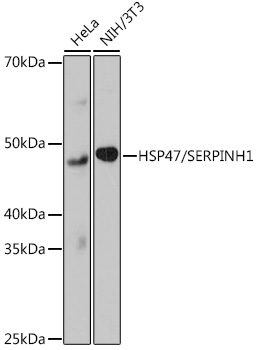 HSP47/SERPINH1 Monoclonal Antibody [3K3H1]