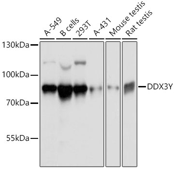 DDX3Y Polyclonal Antibody