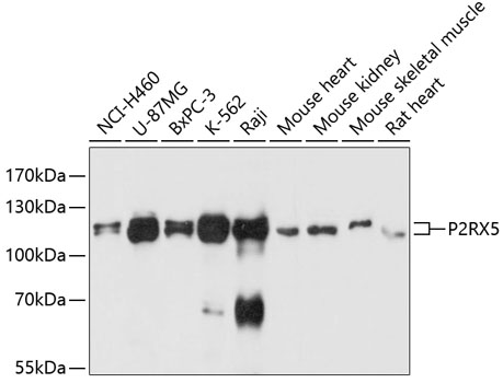 P2RX5 Polyclonal Antibody